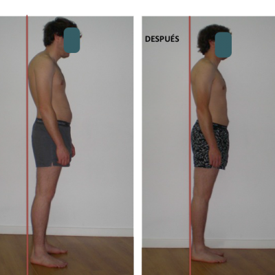 antes y despues1 antes y despues1